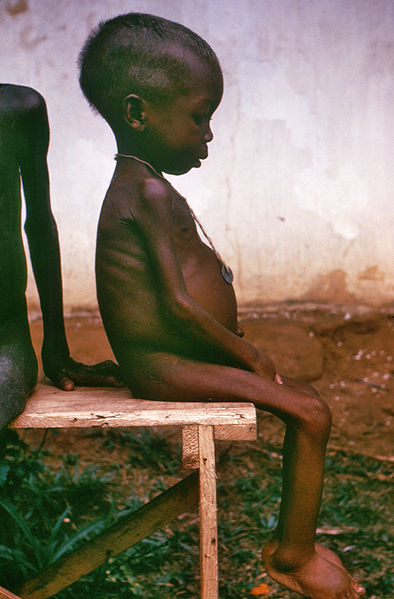"I’m starving" – Are you really?